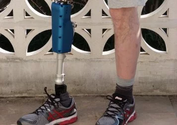 Robotique. La société Millinav travaille sur un genou intelligent